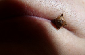 Gewürznelke im Mund